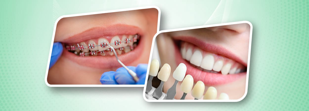 20250708_Berseri-Dental-Clinic-banner
