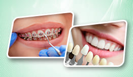 Berseri Dental Clinic - Penawaran Spesial 